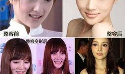 西安整容爆料案件最新,揭开医美行业潜规则与患者权益受损之谜