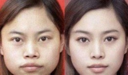 西安整容爆料案件最新,揭开医美行业潜规则与患者权益受损之谜